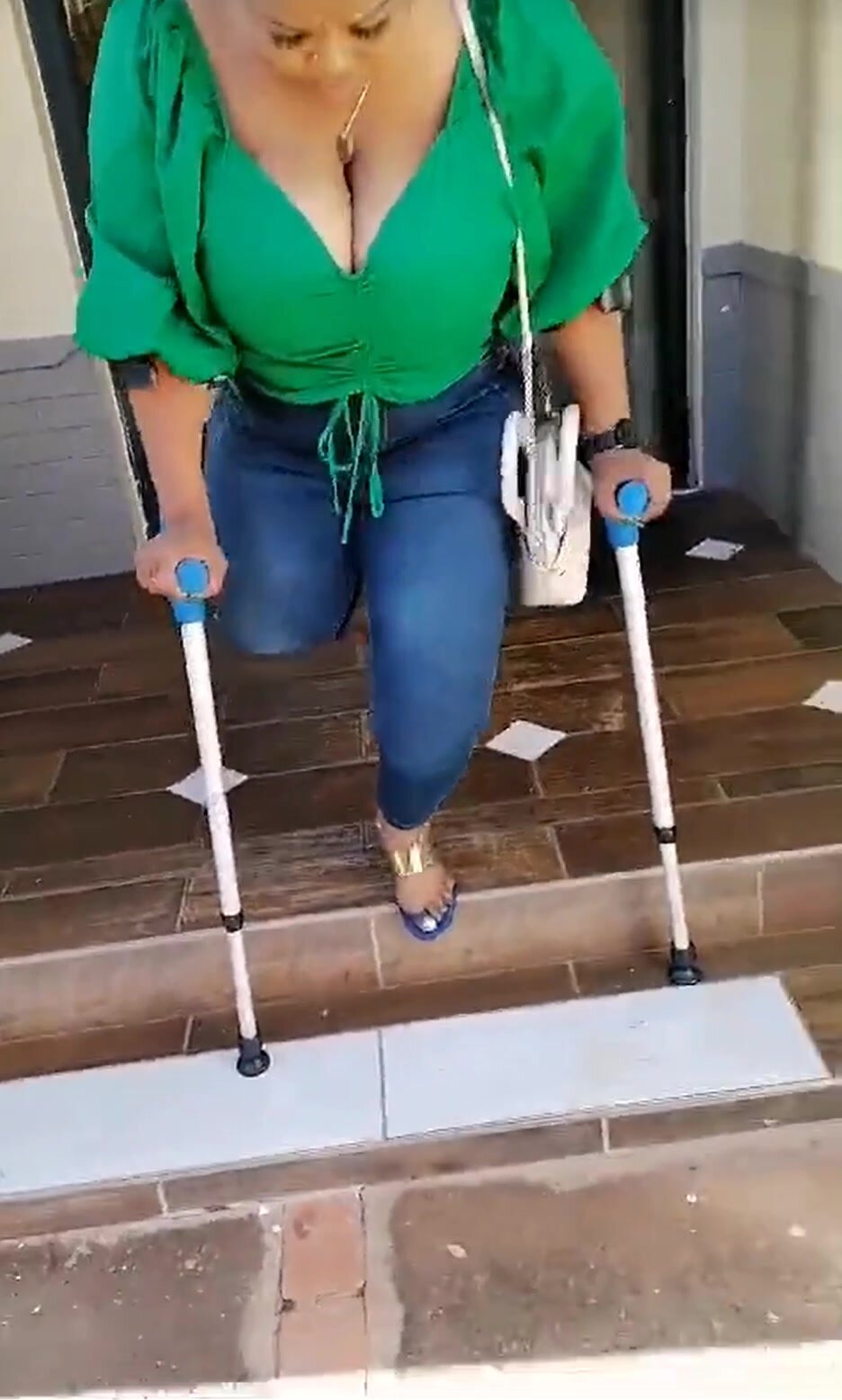 Beautiful black amputee girl crutching