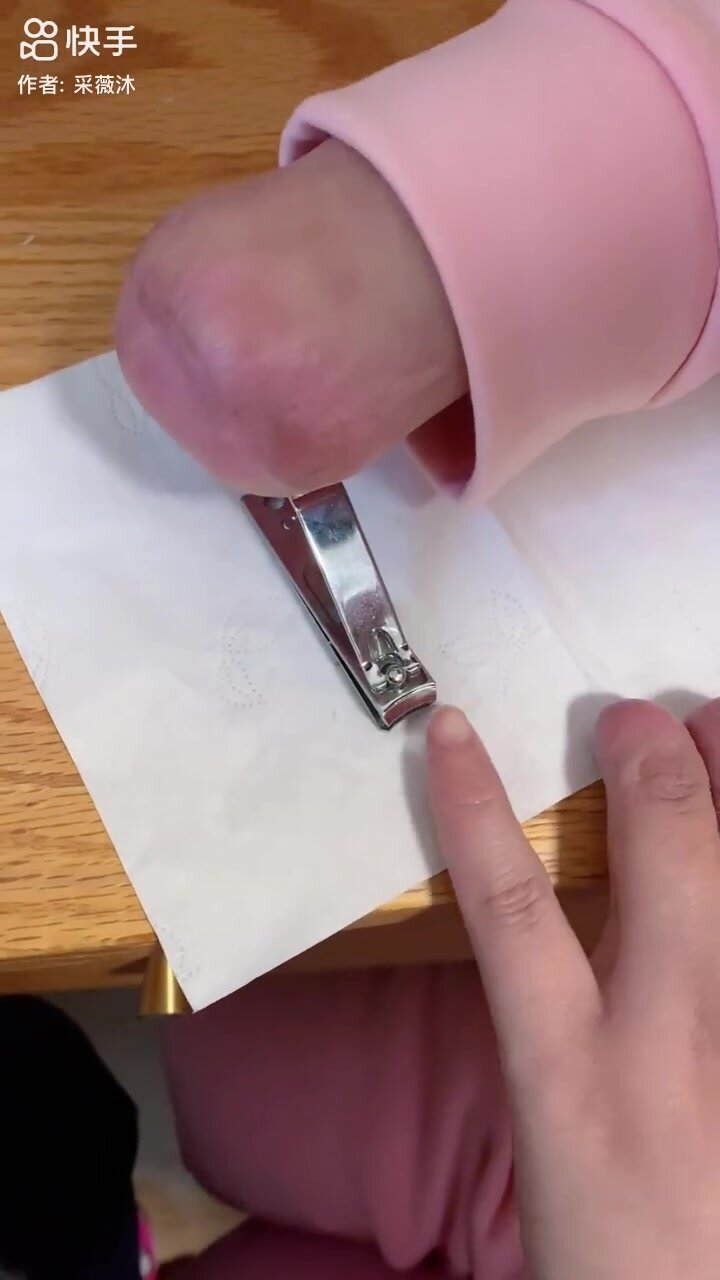 Hand and finger amputee clips nails