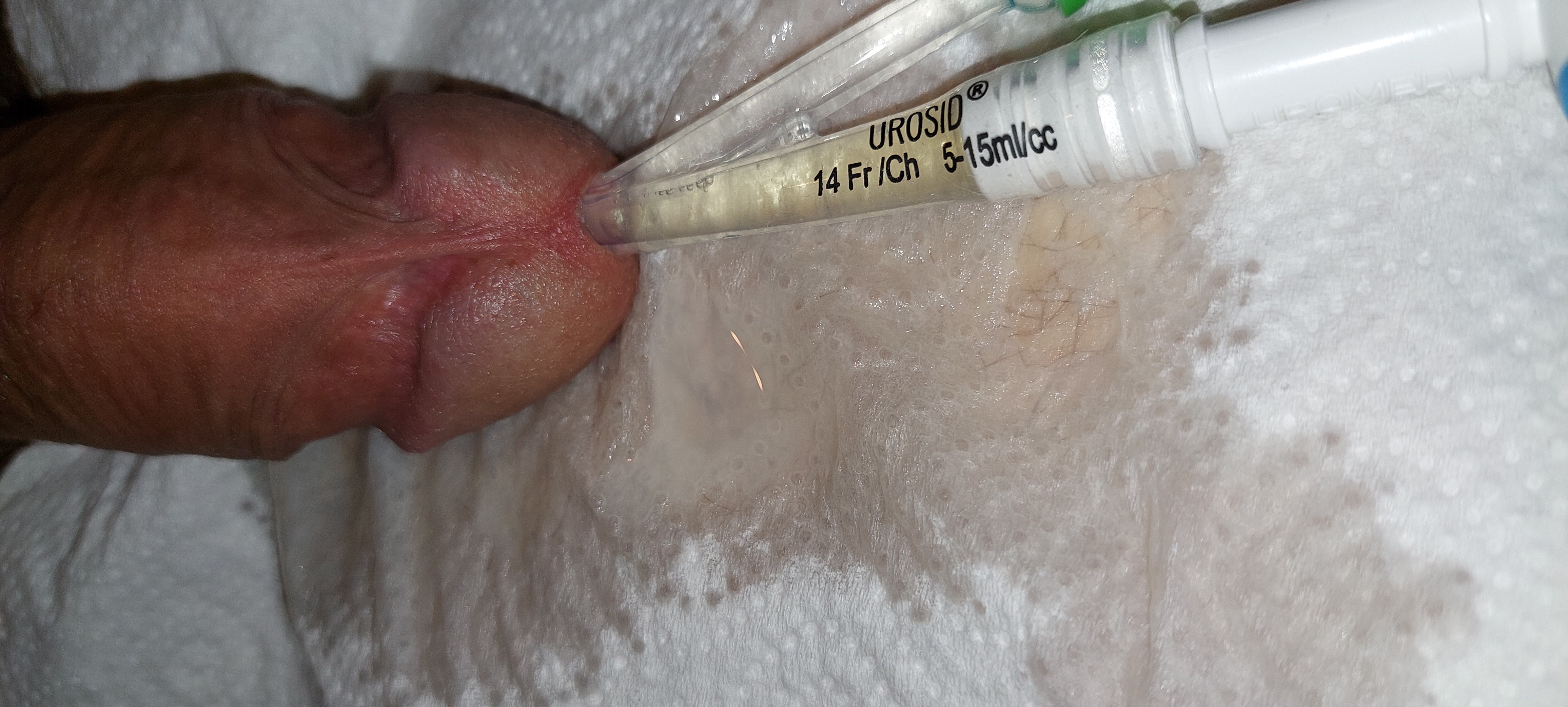 Day 2 silicone foley catheter relieve and orgasm: