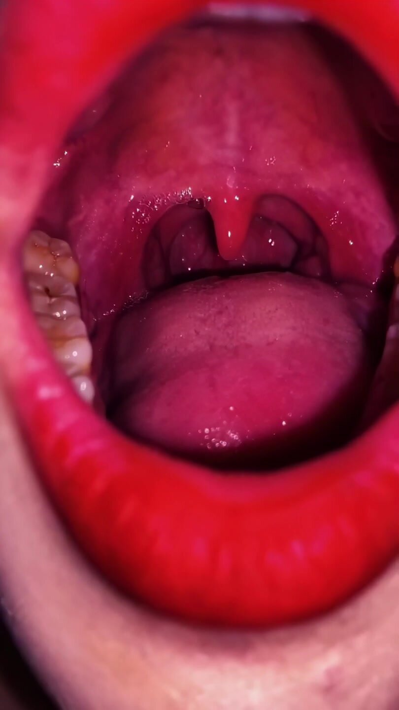 girl uvula B-1