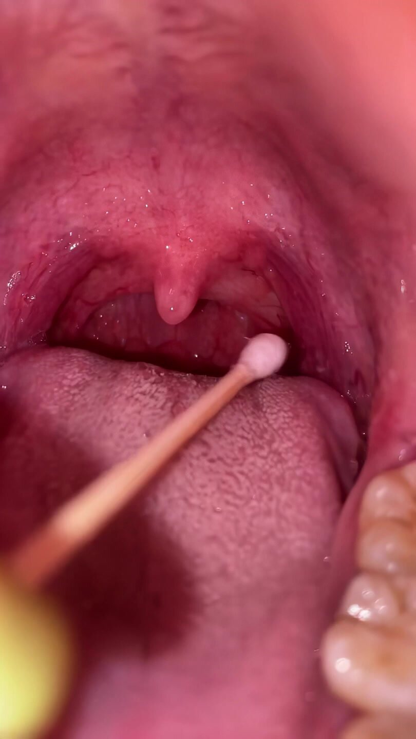 girl uvula D-1 poking