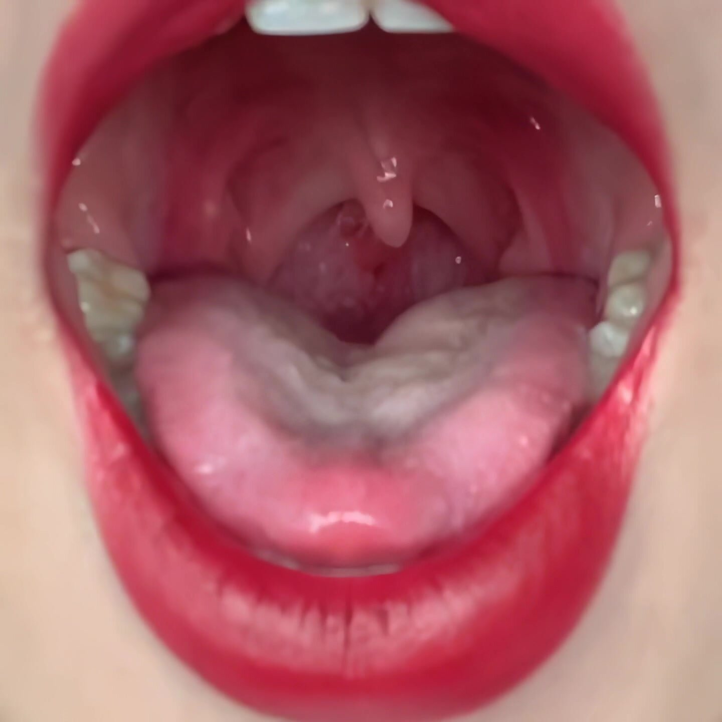 girl uvula O-1
