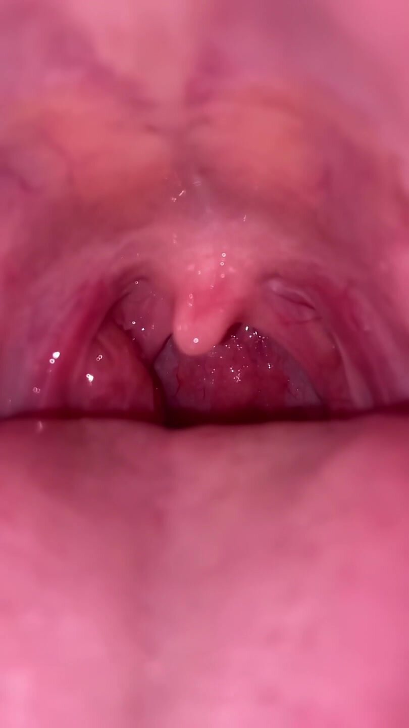 girl uvula V-1