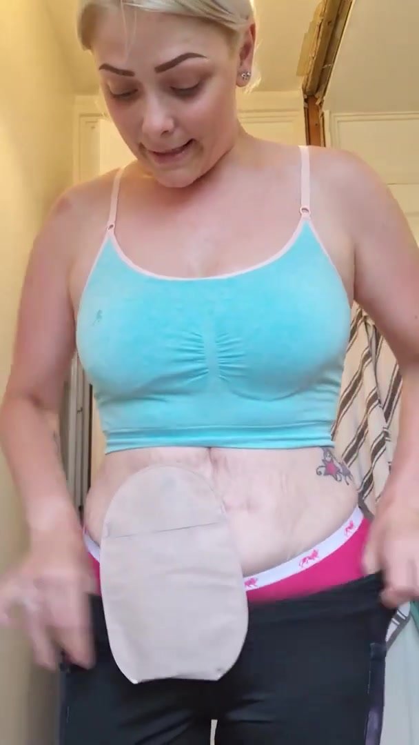 Girl With Ostomy Bag Flashes Pink Panties And Pad Wings