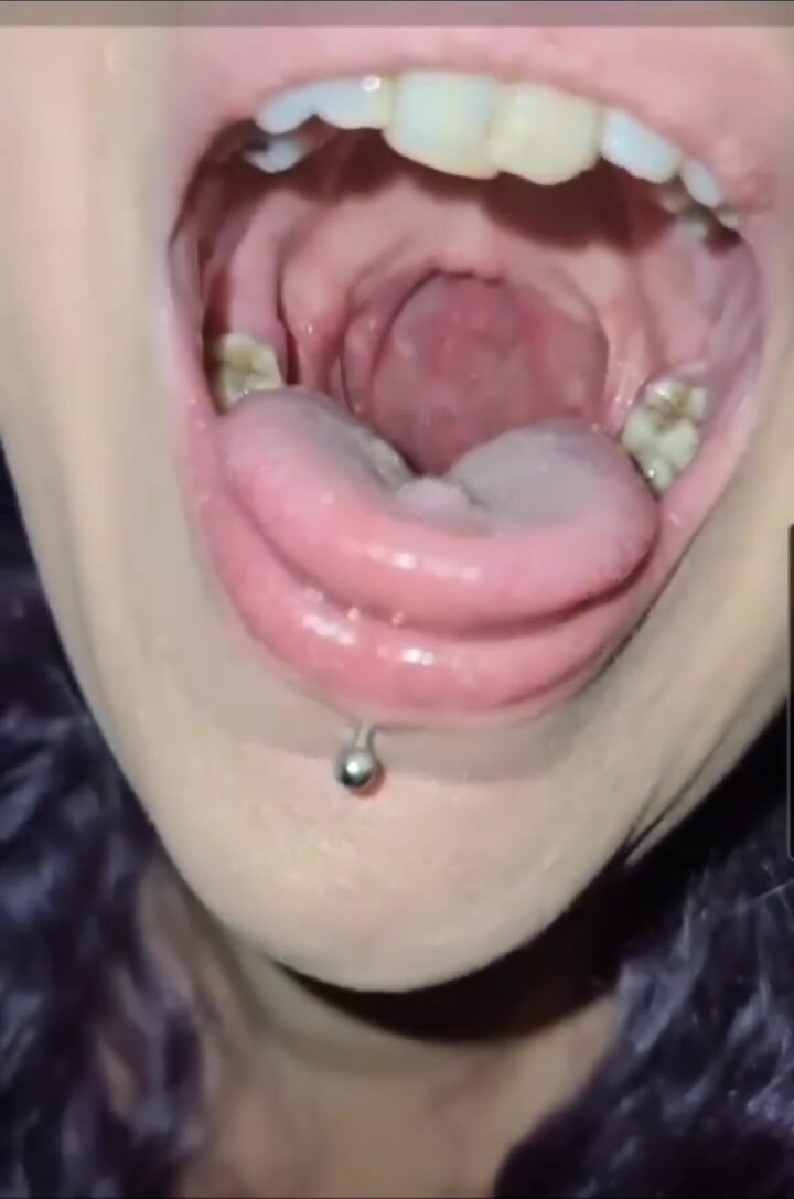 Beautiful girl throat and tongue
