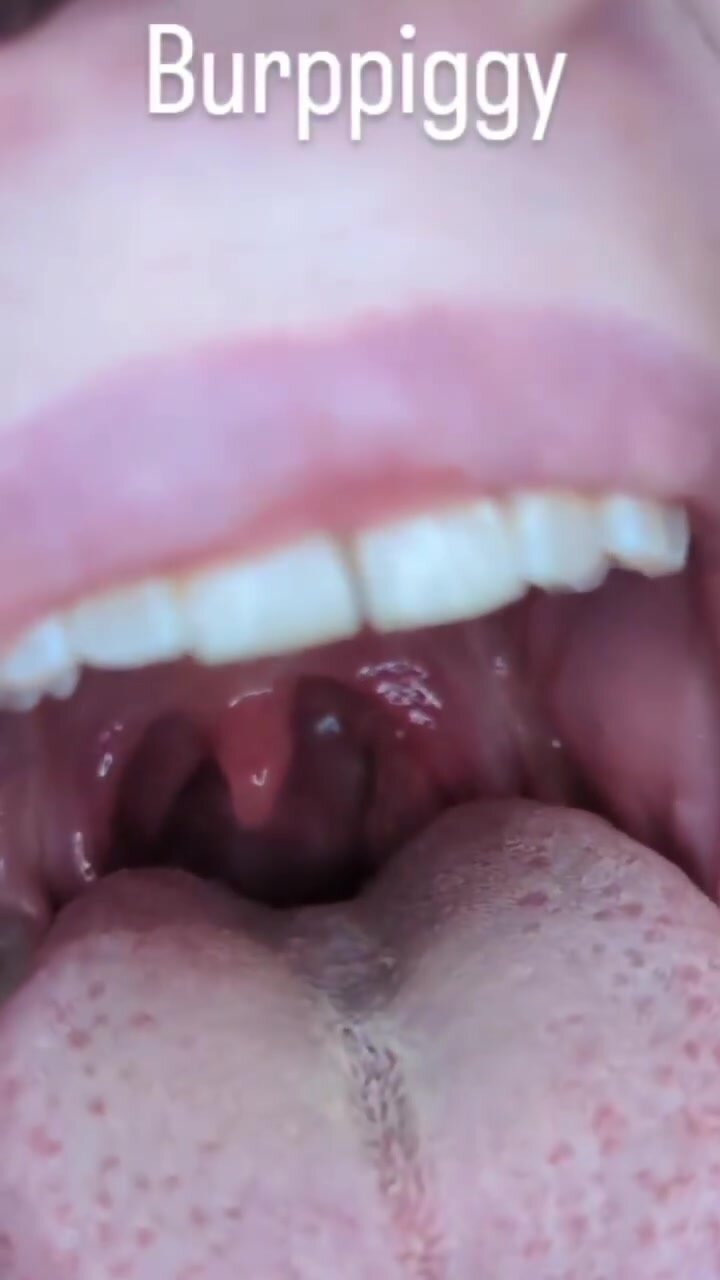 Uvula - video 30
