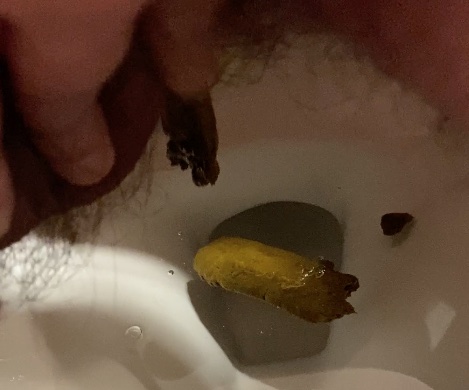 Turds Drop in the Toilet