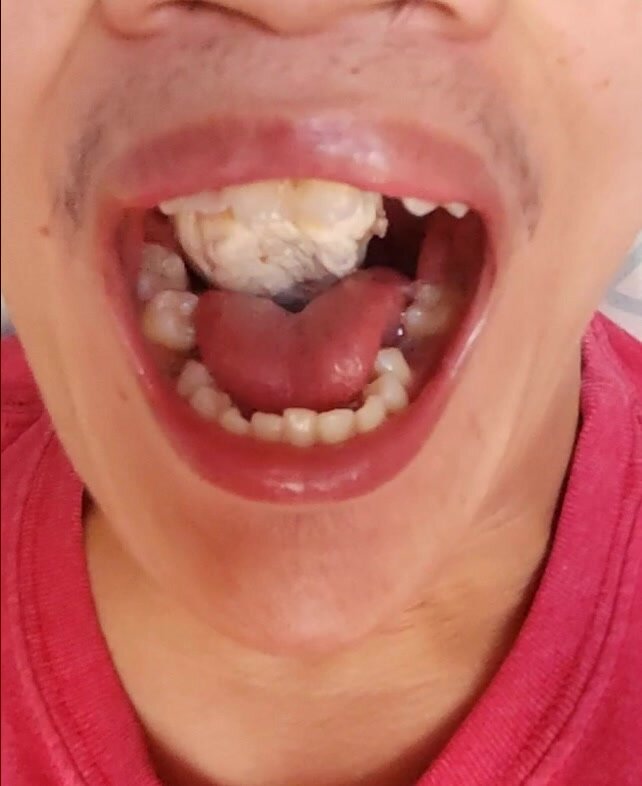 Chicken breast swallowing whole throat vore