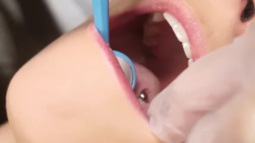 Woman at dentist - video 2