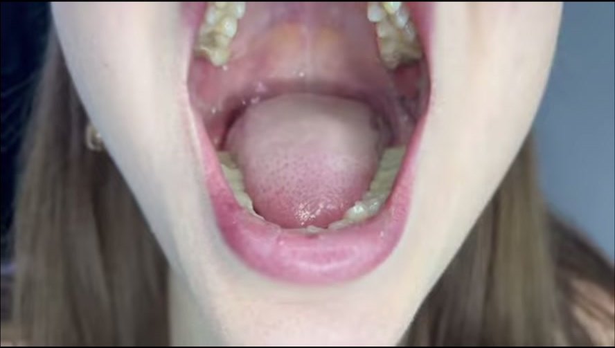 Girl shows her mouth - video 2