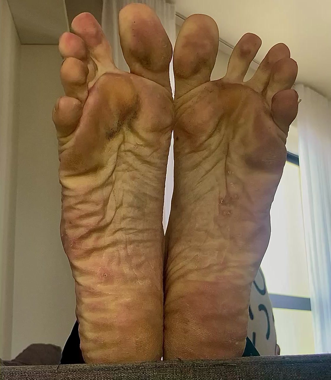 My smelly yellow feet soles
