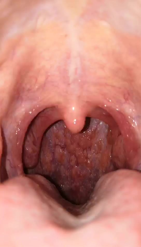girl uvula - video 16