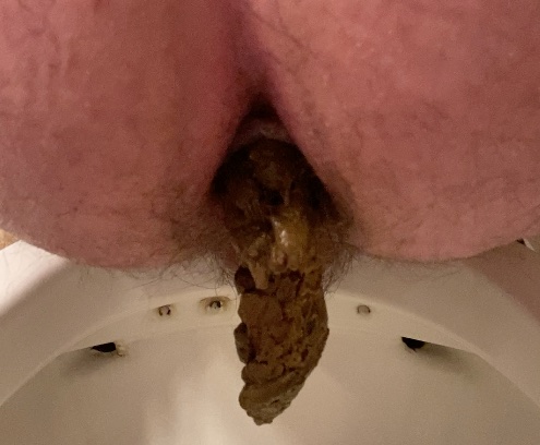 Chunky Turds From My Hole