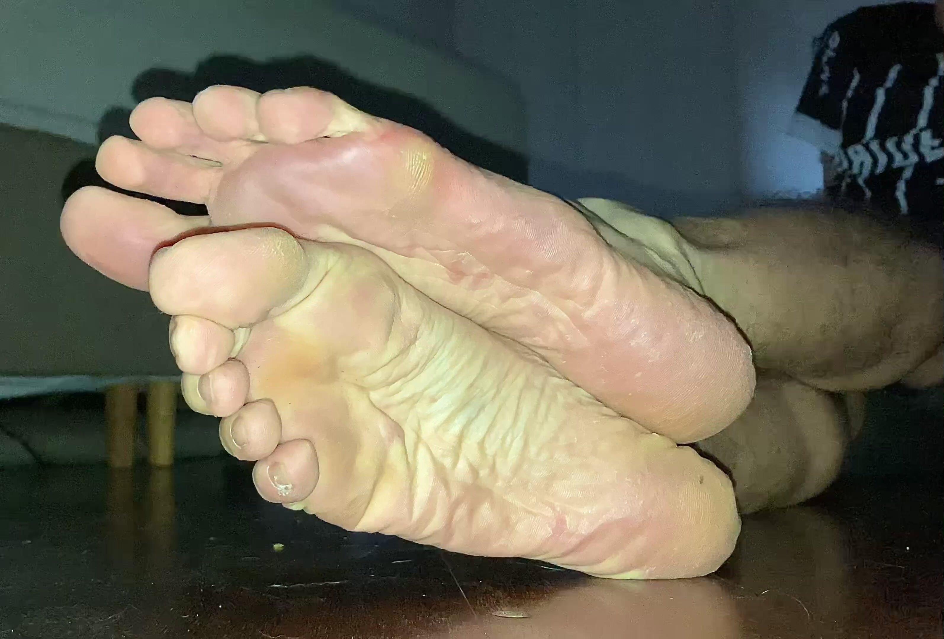 smelly feet - my soles after wearing flipflops all day