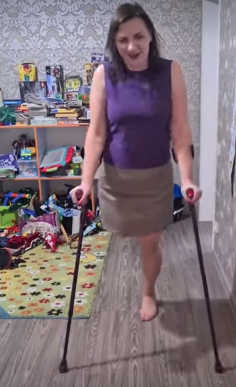 Sexy crutch walk SAK amputee