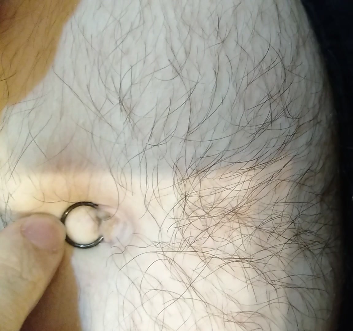 Cleaning my true navel piercing