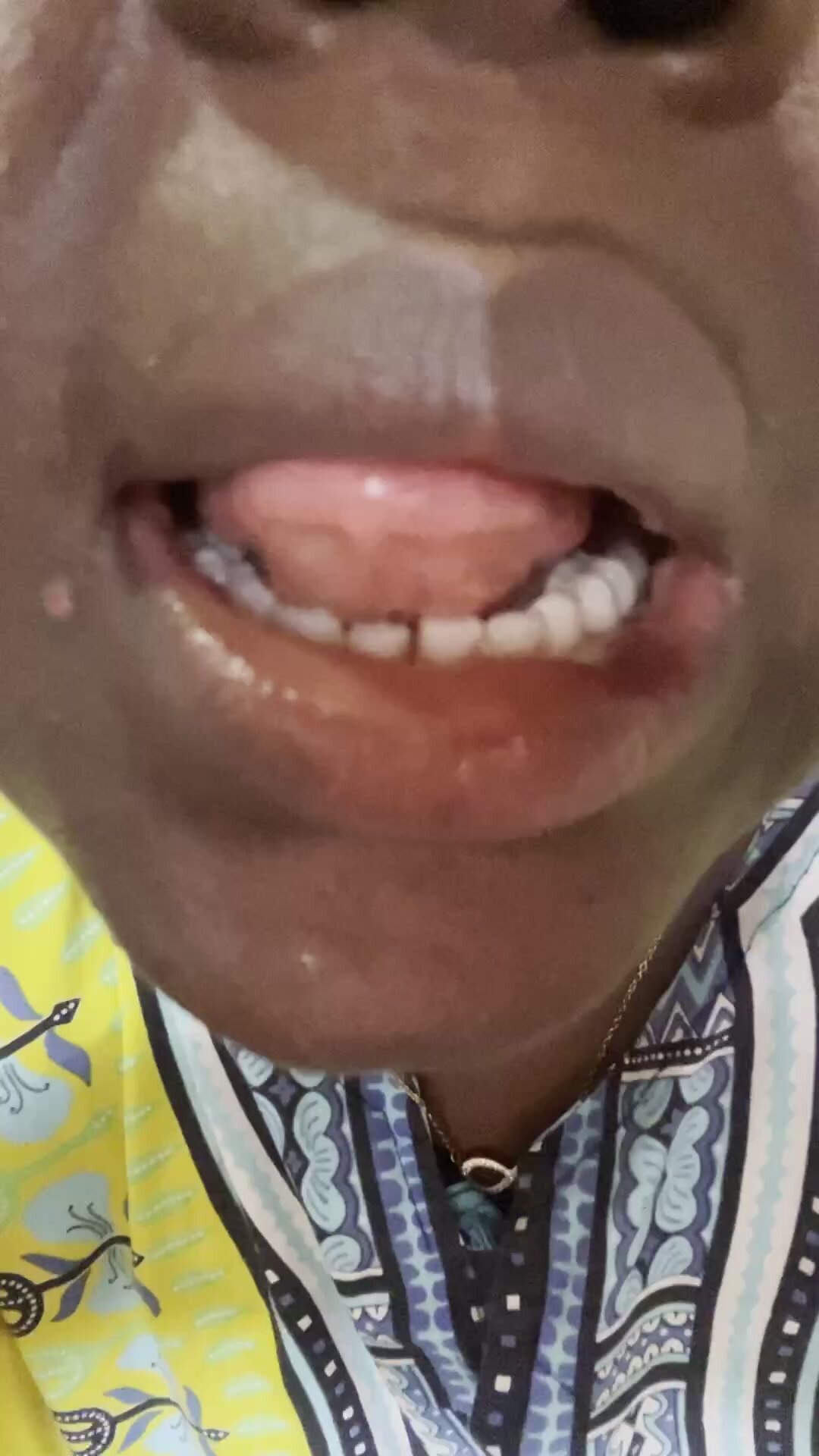 Ebony tongue
