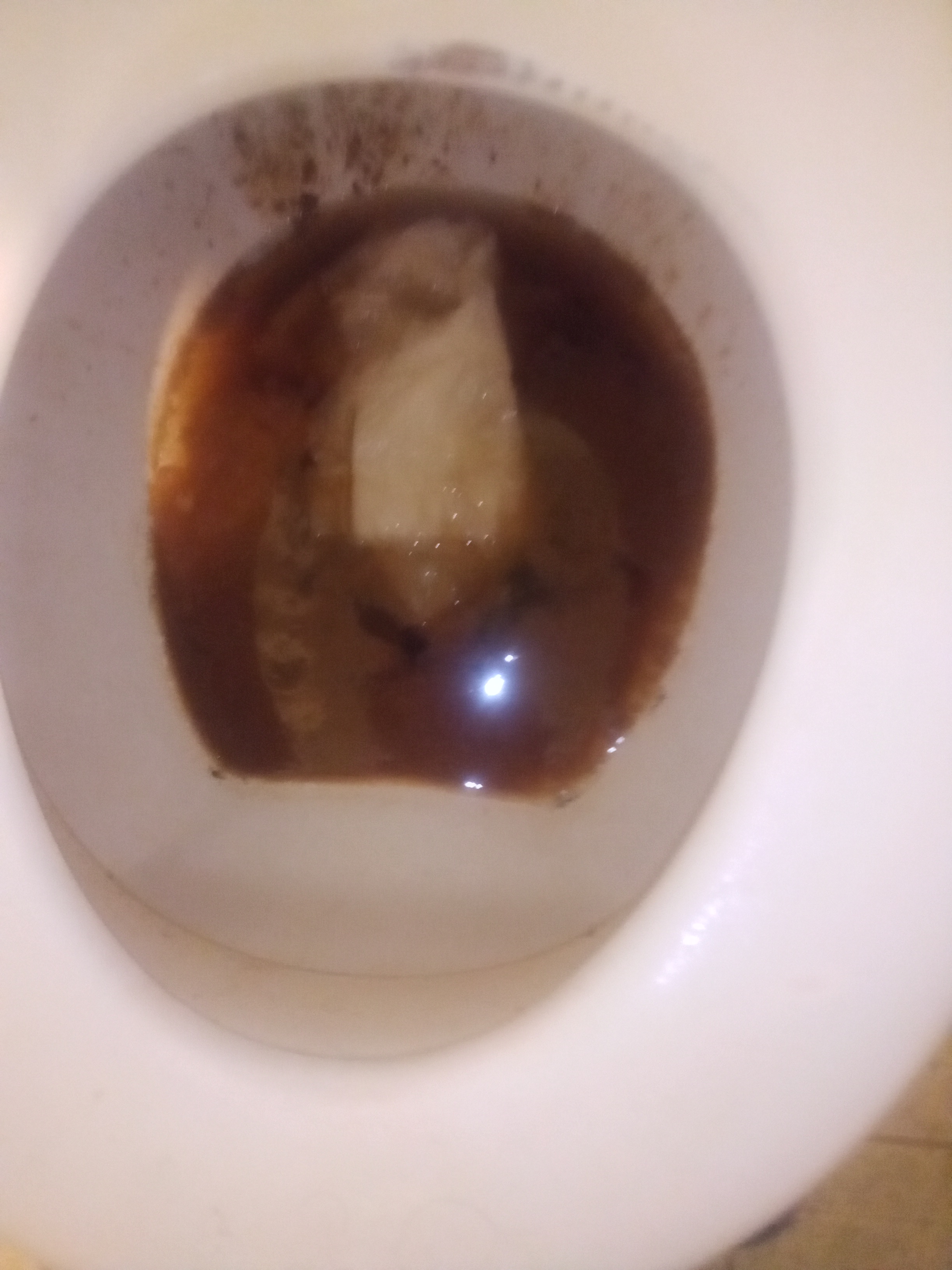 Diarrhea with wet farts from prune juice