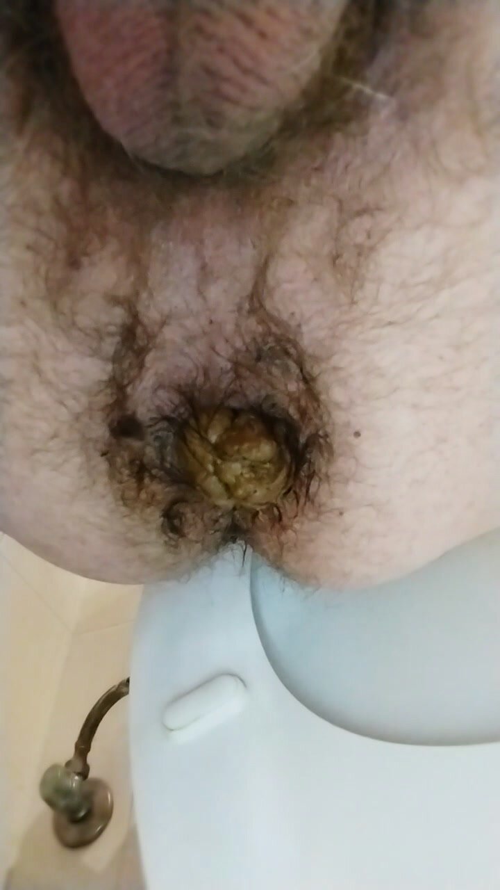 Hard constipated poop - video 3