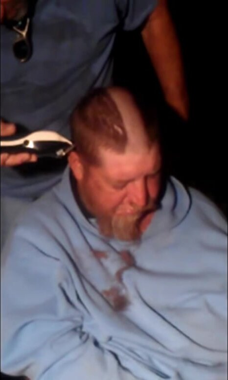Passed out man loses belly, head, and beard hair