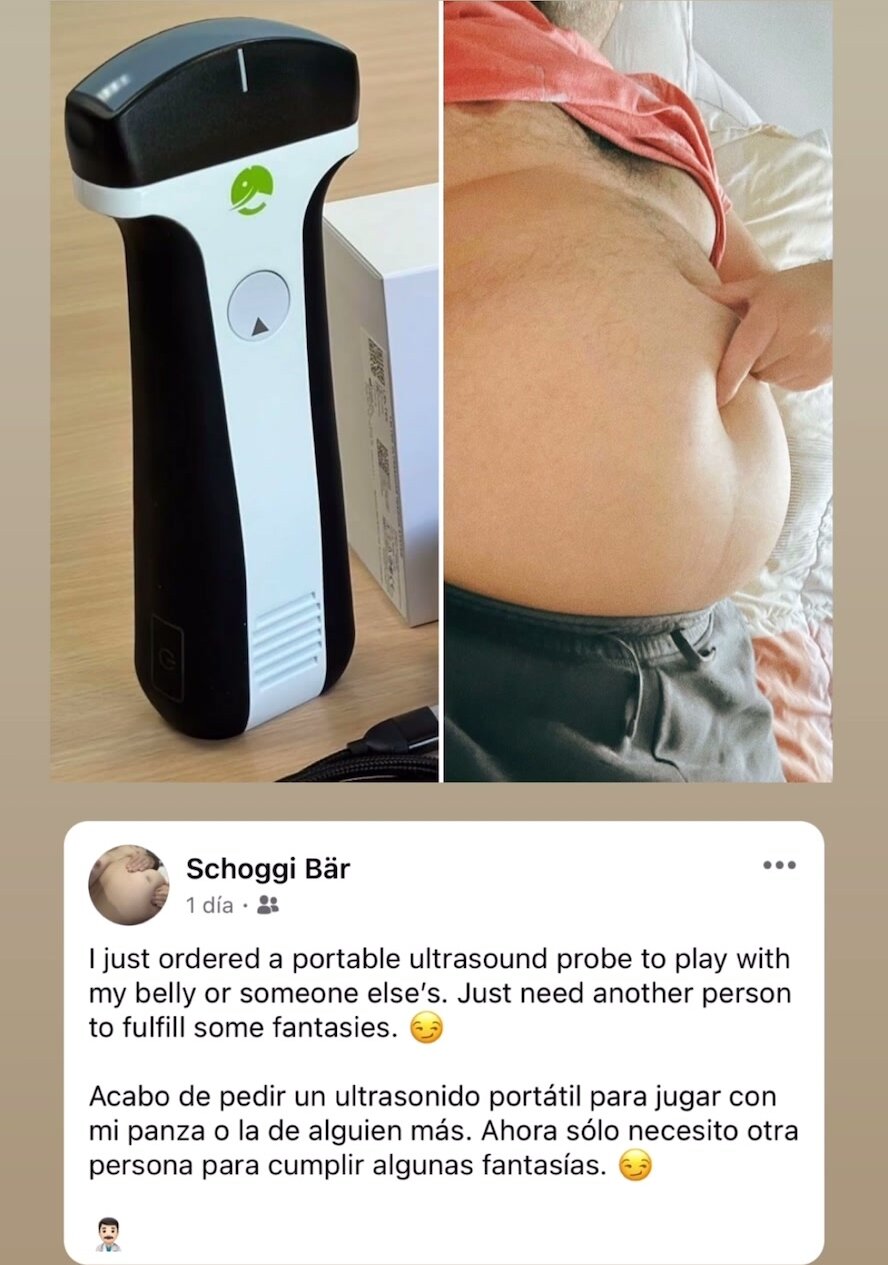 (Announcement) ultrasound belly