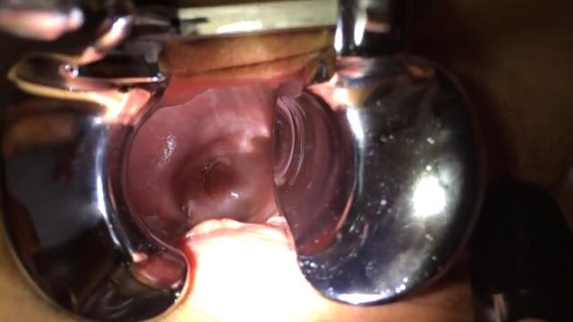 Cervix view with orgasm