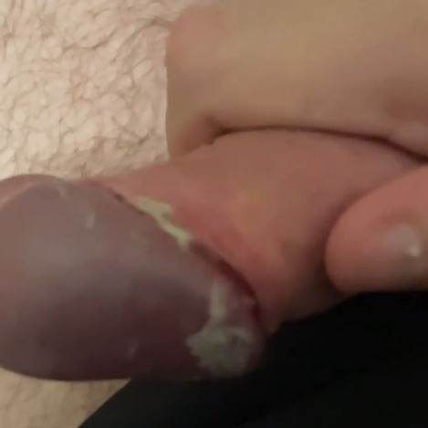 Aussie 22yo showing off my dick cheese smegma