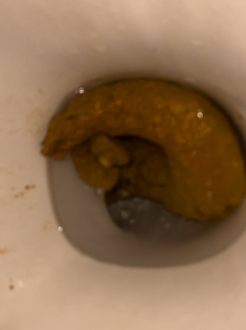 The largest turd I pooped