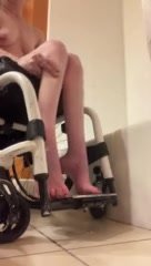 Paraplegic feet - video 5