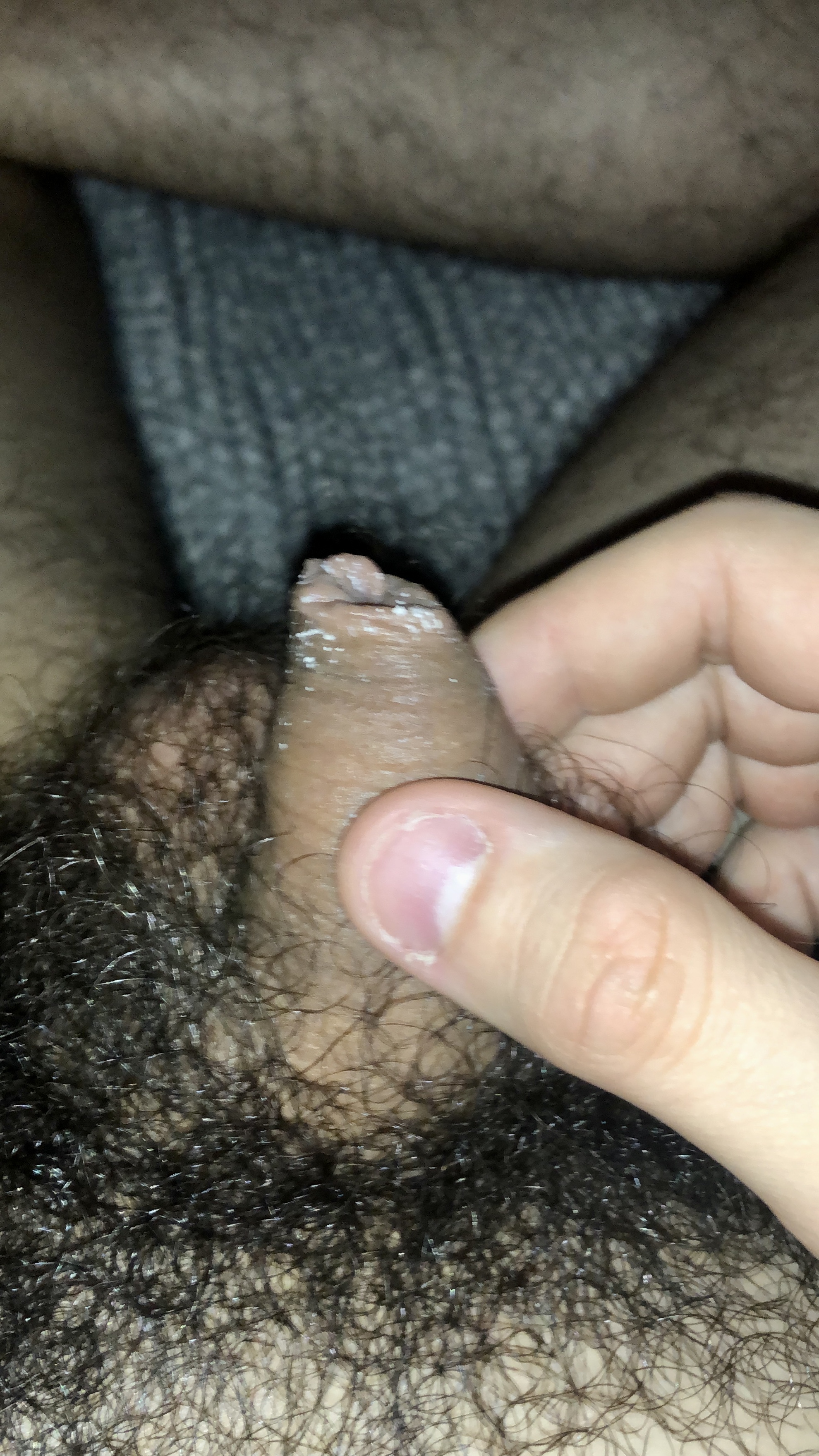 wet smelly hairy tiny dick with smegma