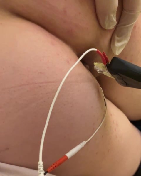 Anal needle enhanced stimulation
