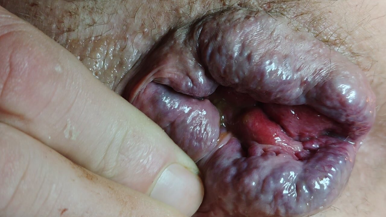 Scat ass close up - shitting anal gape