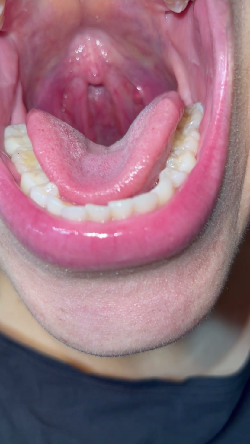 Beautiful mouth