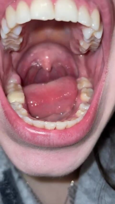 Beautiful girl showing her mouth