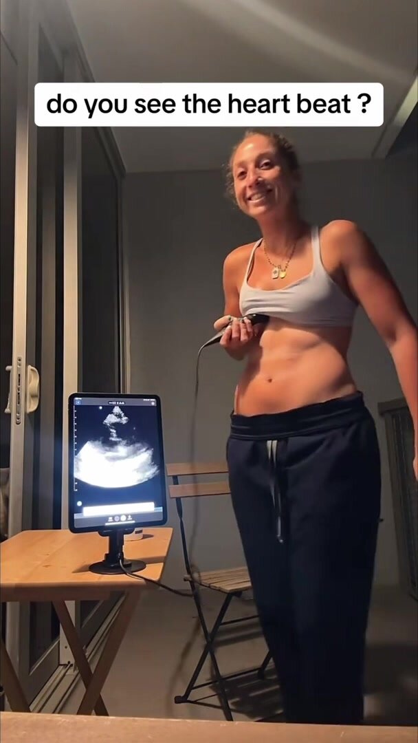 Ultrasound Heartbeat - video 2