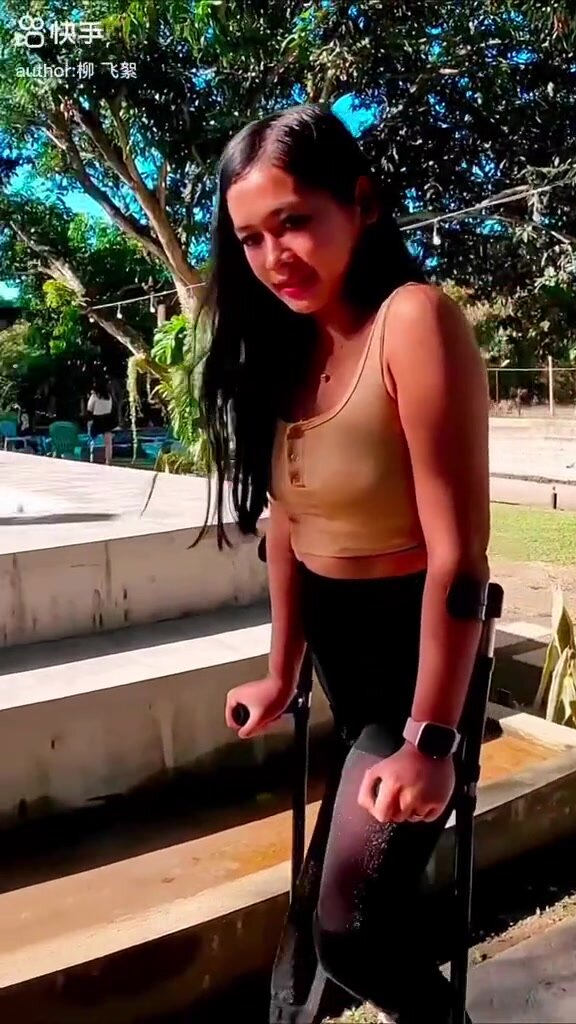 Amputee girl in crutches - video 2