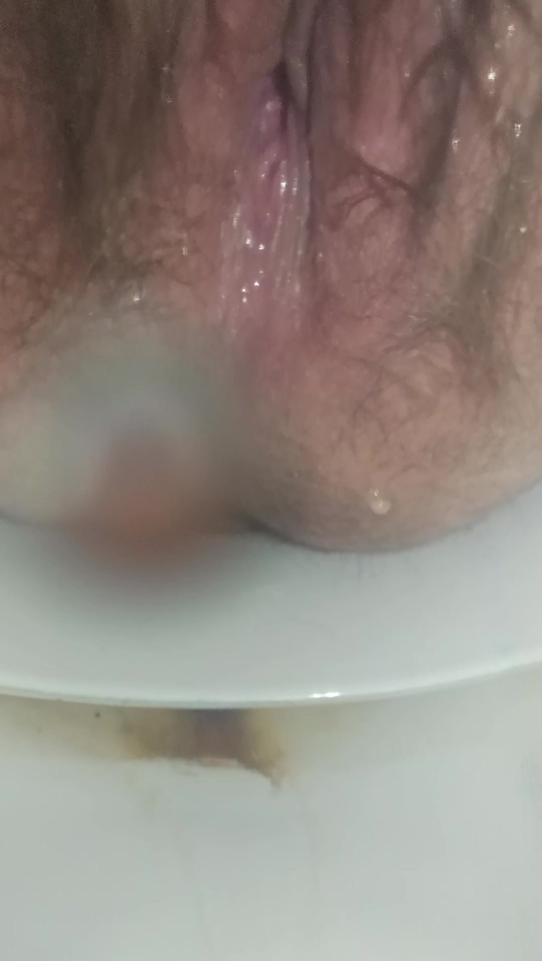 Can't stop pooping - video 3
