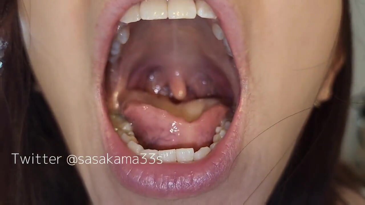 girl uvula 13