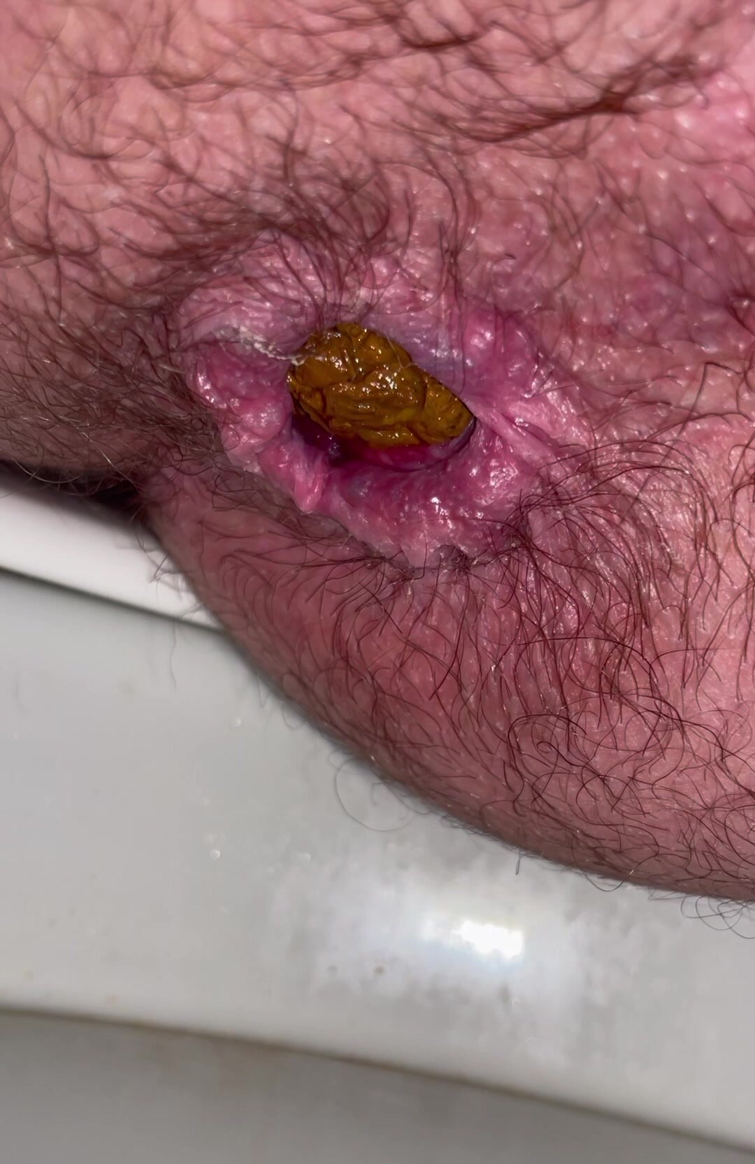 Dirty hairy hole release