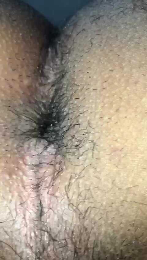 Hairy cheeks spreading and smelly hole