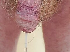 Catheter piss - video 2