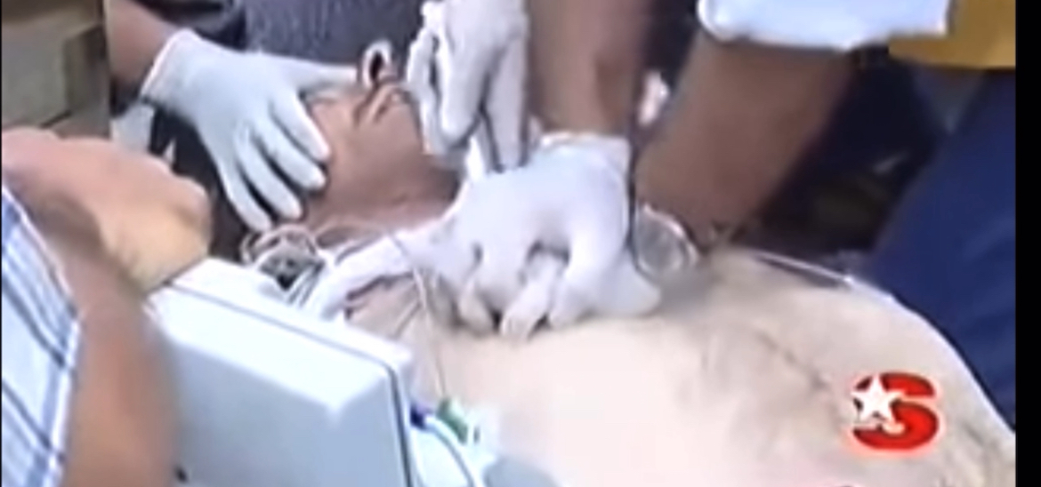 Real CPR, defibs, intubation on man in cardiac arrest