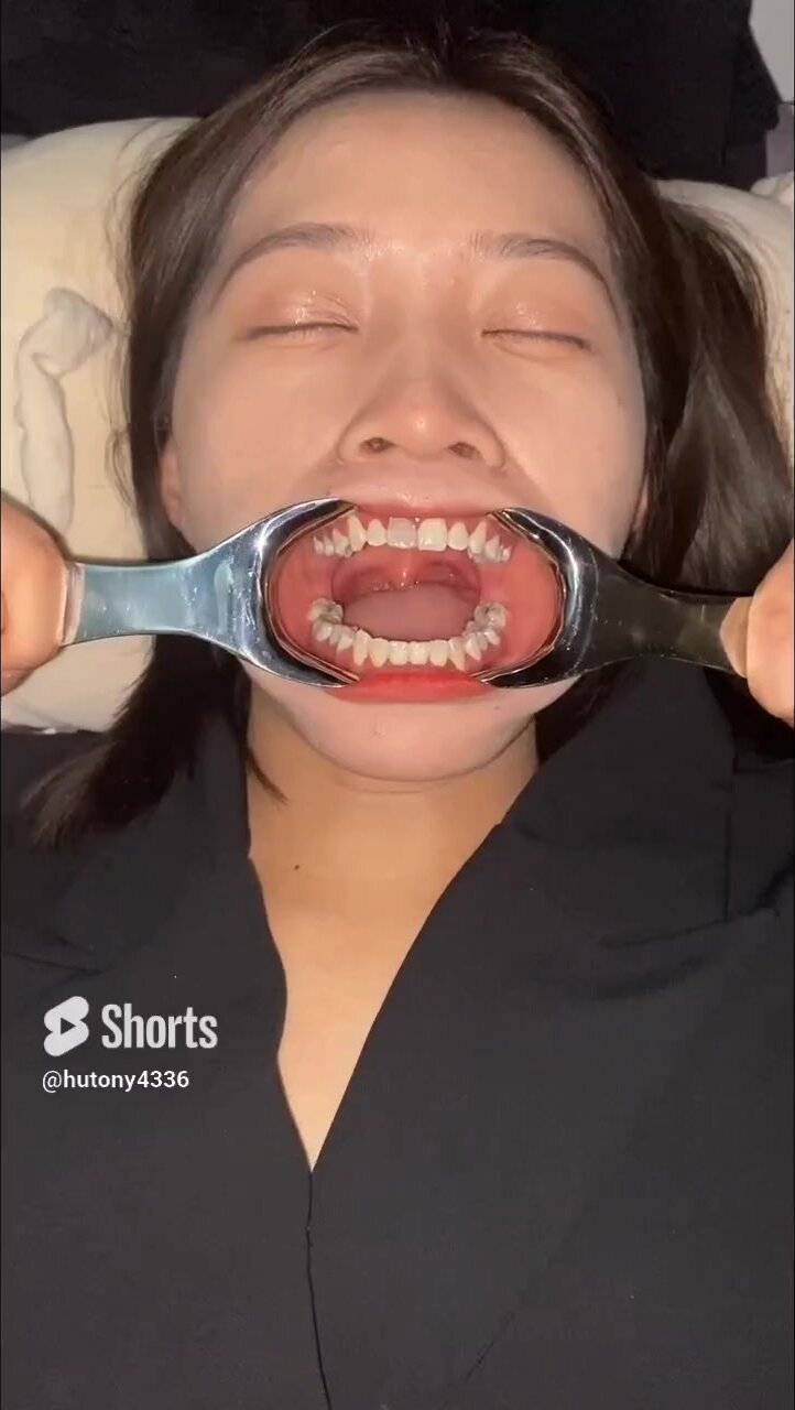 女大学生口腔检查Fetish decay teeth,Asian