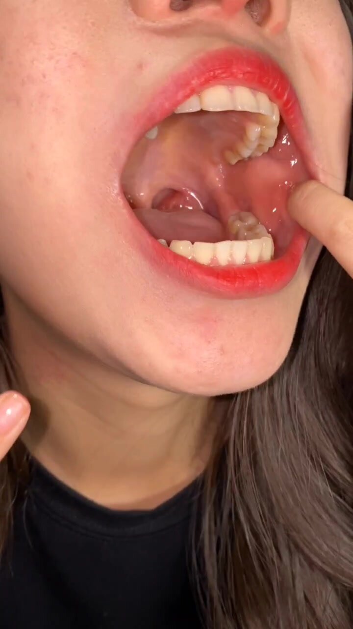 女大学生口腔检查Fetish decay teeth,Asian - video 4