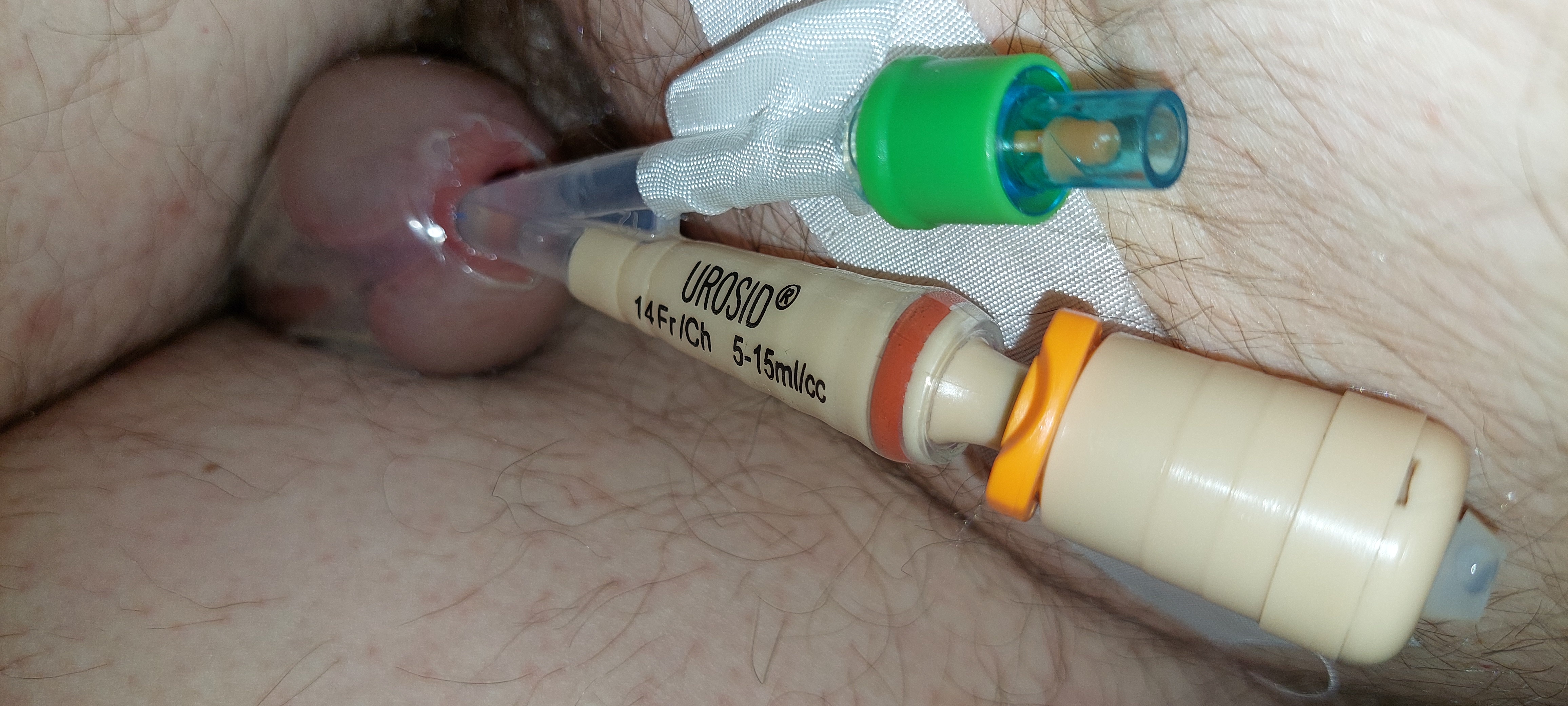 Foley catheter orgasm day 3