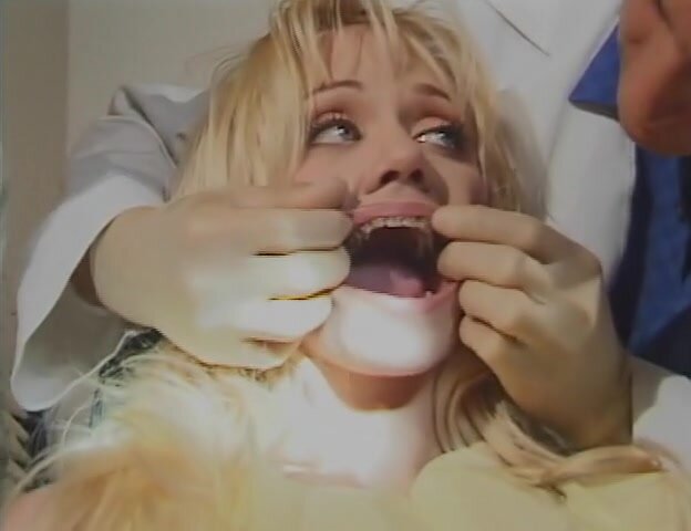 Dentist braces fillings