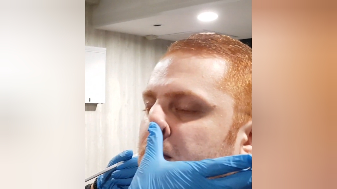 Nose play treatment