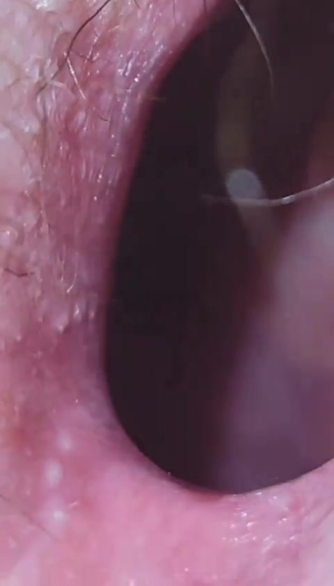 Gaped hole upclose