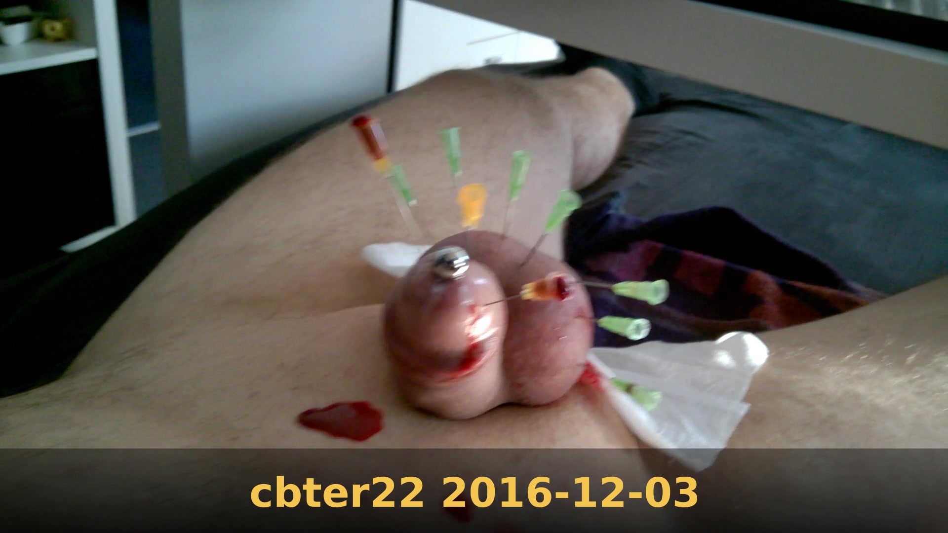 Removing needles on 2016-12-03