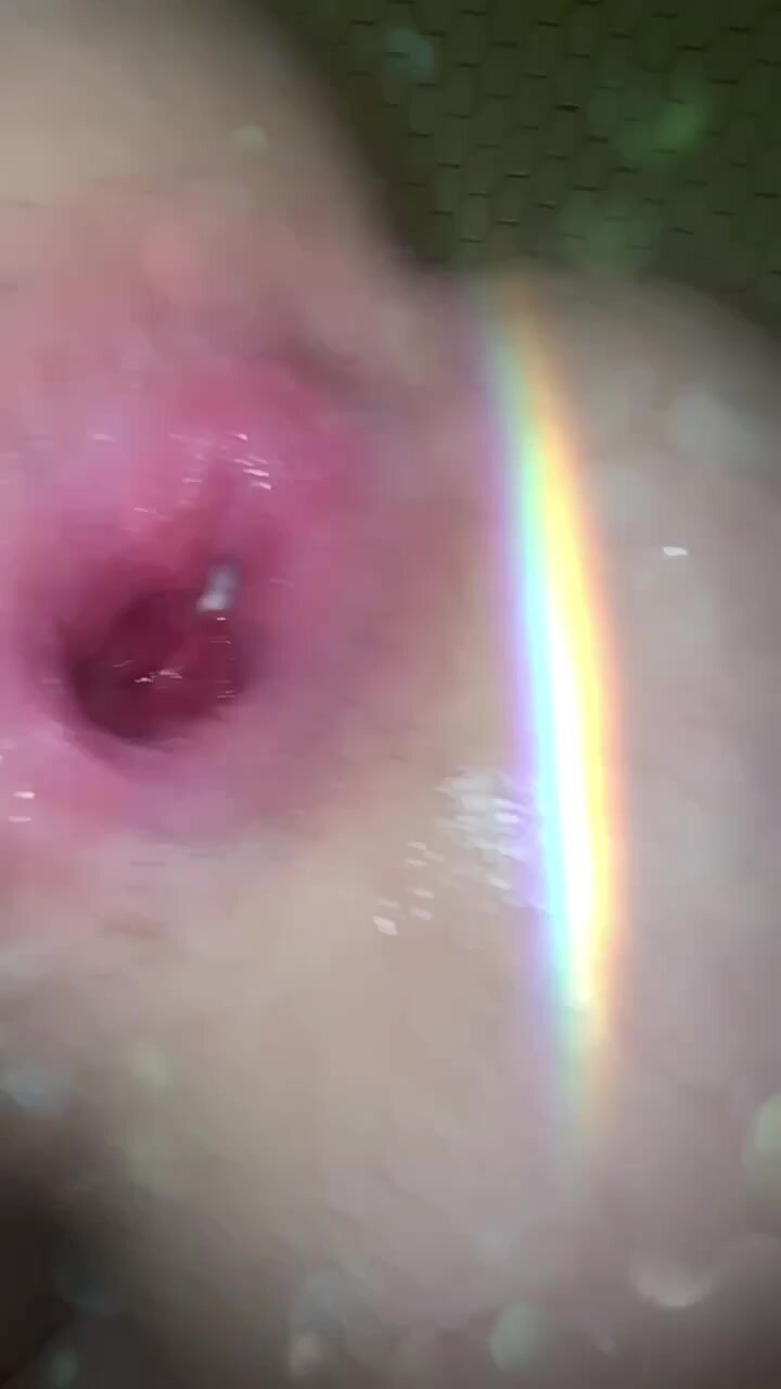 Public Buttslut Zagsags At It Again